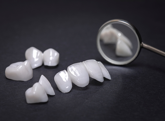 Several white dental crowns and veneers on table next to dental mirror