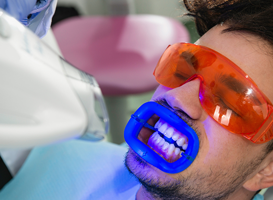 Man in dental chair getting his teeth professionally whitened