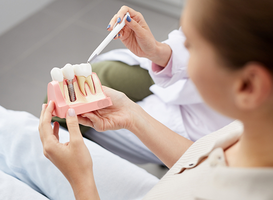 Dentist showing a model of a dental implant to a patient