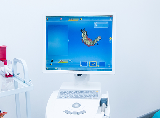 Computer monitor showing a digital model of teeth