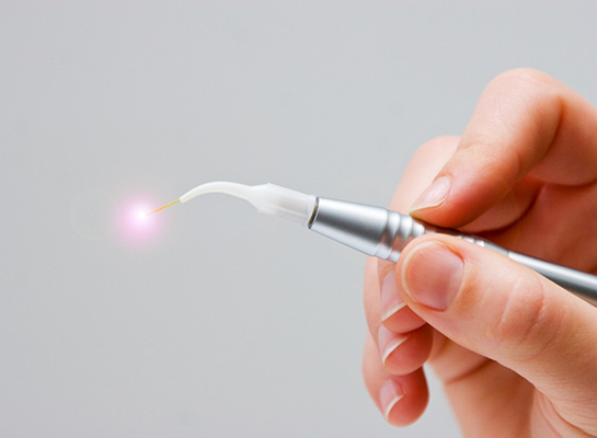 Hand holding a pen like dental laser device