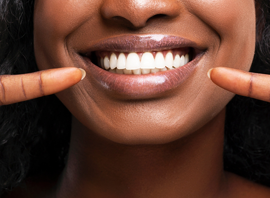 Close up of person with white teeth pointing to their smile